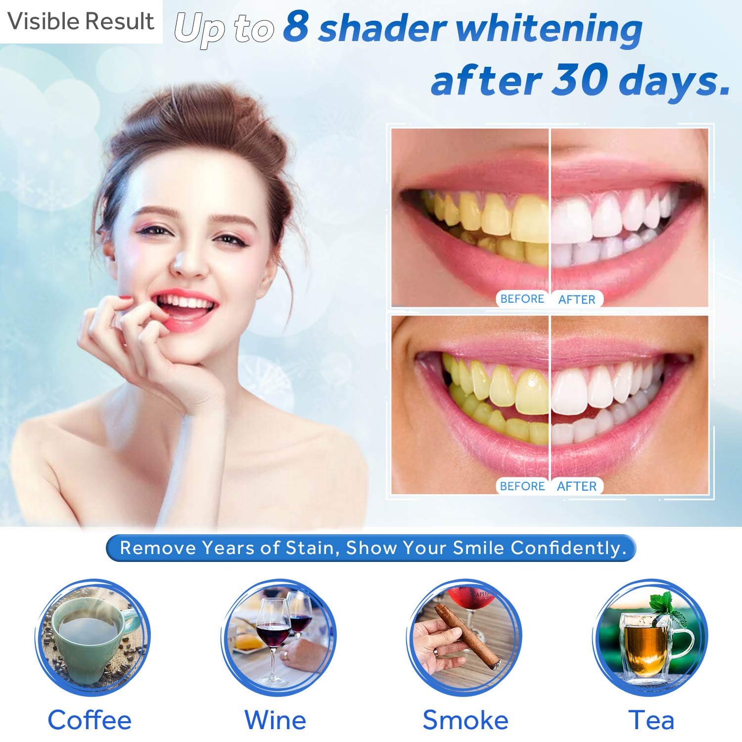 Zahnaufhellungsgel, Nachfüllsp – Teeth Whitening Near Me Bewertung und Preis